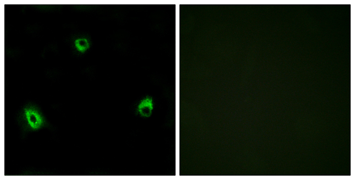 OR10A4 Antibody - Immunofluorescence analysis of MCF7 cells, using OR10A4 Antibody. The picture on the right is blocked with the synthesized peptide.