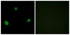 OR10A4 Antibody - Immunofluorescence analysis of MCF7 cells, using OR10A4 Antibody. The picture on the right is blocked with the synthesized peptide.