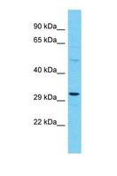 OR10A4 Antibody - Western blot of Human 721_B. OR10A4 antibody dilution 1.0 ug/ml.  This image was taken for the unconjugated form of this product. Other forms have not been tested.