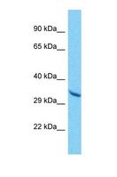 OR10A6 Antibody - Western blot of Human A549. OR10A6 antibody dilution 1.0 ug/ml.  This image was taken for the unconjugated form of this product. Other forms have not been tested.