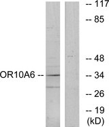 OR10A6 Antibody - Western blot analysis of lysates from A549 cells, using OR10A6 Antibody. The lane on the right is blocked with the synthesized peptide.