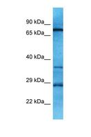 OR10A6 Antibody - Western blot of Human MCF7. OR10A6 antibody dilution 1.0 ug/ml.  This image was taken for the unconjugated form of this product. Other forms have not been tested.