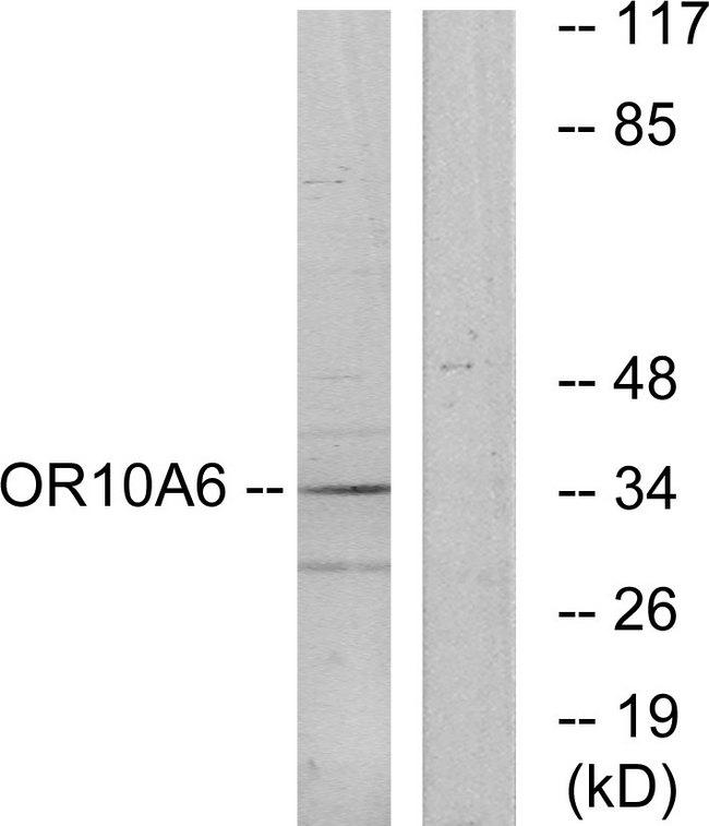 OR10A6 Antibody - Western blot analysis of extracts from A549 cells, using OR10A6 antibody.