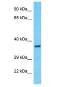 OR10A7 Antibody - OR10A7 antibody Western Blot of A549. Antibody dilution: 1 ug/ml.  This image was taken for the unconjugated form of this product. Other forms have not been tested.