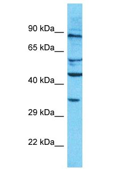 OR10AD1 Antibody - OR10AD1 antibody Western Blot of HepG2. Antibody dilution: 1 ug/ml.  This image was taken for the unconjugated form of this product. Other forms have not been tested.
