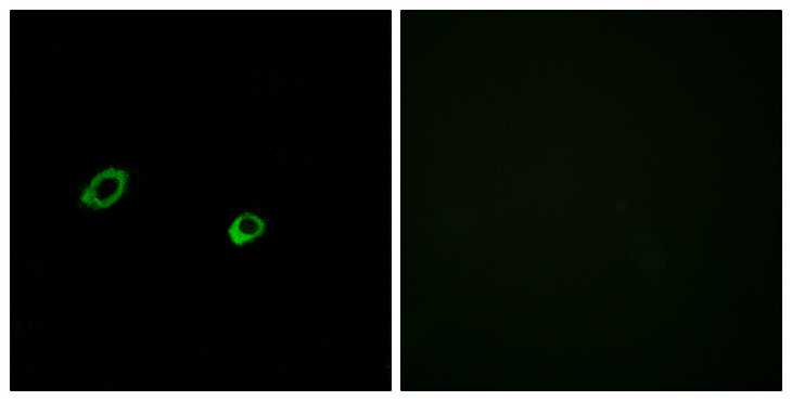 OR10AG1 Antibody - Immunofluorescence analysis of MCF7 cells, using OR10AG1 Antibody. The picture on the right is blocked with the synthesized peptide.