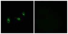 OR10G2 Antibody - Immunofluorescence analysis of MCF7 cells, using OR10G2 Antibody. The picture on the right is blocked with the synthesized peptide.