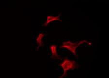 OR10G2 Antibody - Staining HuvEc cells by IF/ICC. The samples were fixed with PFA and permeabilized in 0.1% Triton X-100, then blocked in 10% serum for 45 min at 25°C. The primary antibody was diluted at 1:200 and incubated with the sample for 1 hour at 37°C. An Alexa Fluor 594 conjugated goat anti-rabbit IgG (H+L) Ab, diluted at 1/600, was used as the secondary antibody.
