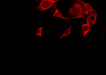 OR10G4 Antibody - Staining HeLa cells by IF/ICC. The samples were fixed with PFA and permeabilized in 0.1% Triton X-100, then blocked in 10% serum for 45 min at 25°C. The primary antibody was diluted at 1:200 and incubated with the sample for 1 hour at 37°C. An Alexa Fluor 594 conjugated goat anti-rabbit IgG (H+L) Ab, diluted at 1/600, was used as the secondary antibody.