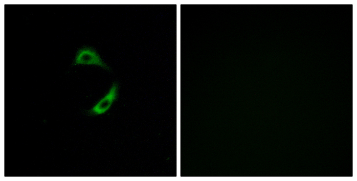 OR10G9 Antibody - Immunofluorescence analysis of A549 cells, using OR10G9 Antibody. The picture on the right is blocked with the synthesized peptide.