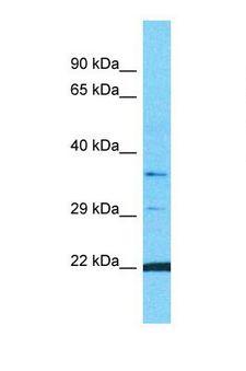 OR10G9 Antibody - Western blot of Human MCF7. OR10G9 antibody dilution 1.0 ug/ml.  This image was taken for the unconjugated form of this product. Other forms have not been tested.