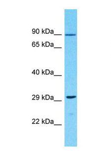 OR10G9 Antibody - Western blot of Human 721_B. OR10G9 antibody dilution 1.0 ug/ml.  This image was taken for the unconjugated form of this product. Other forms have not been tested.