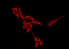OR10H1 Antibody - Staining HeLa cells by IF/ICC. The samples were fixed with PFA and permeabilized in 0.1% Triton X-100, then blocked in 10% serum for 45 min at 25°C. The primary antibody was diluted at 1:200 and incubated with the sample for 1 hour at 37°C. An Alexa Fluor 594 conjugated goat anti-rabbit IgG (H+L) Ab, diluted at 1/600, was used as the secondary antibody.