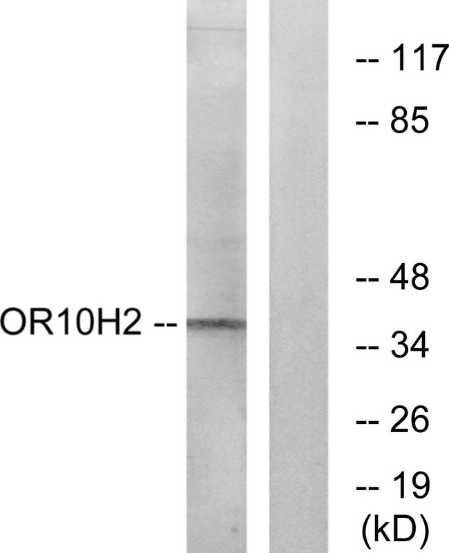 OR10H2 Antibody - Western blot analysis of lysates from A549 cells, using OR10H2 Antibody. The lane on the right is blocked with the synthesized peptide.