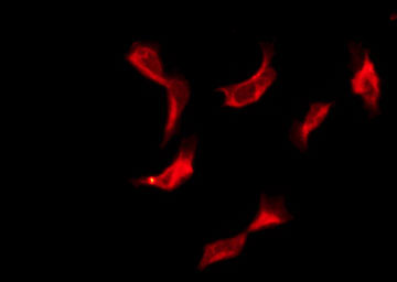OR10H2 Antibody - Staining A549 cells by IF/ICC. The samples were fixed with PFA and permeabilized in 0.1% Triton X-100, then blocked in 10% serum for 45 min at 25°C. The primary antibody was diluted at 1:200 and incubated with the sample for 1 hour at 37°C. An Alexa Fluor 594 conjugated goat anti-rabbit IgG (H+L) Ab, diluted at 1/600, was used as the secondary antibody.