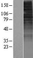 OR10H2 Protein - Western validation with an anti-DDK antibody * L: Control HEK293 lysate R: Over-expression lysate