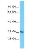 OR10H4 Antibody - OR10H4 antibody Western Blot of HCT15. Antibody dilution: 1 ug/ml.  This image was taken for the unconjugated form of this product. Other forms have not been tested.