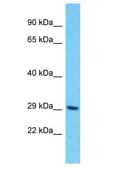 OR10H4 Antibody - OR10H4 antibody Western Blot of HCT15. Antibody dilution: 1 ug/ml.  This image was taken for the unconjugated form of this product. Other forms have not been tested.