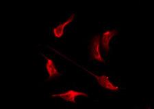 OR10H4 Antibody - Staining RAW264.7 cells by IF/ICC. The samples were fixed with PFA and permeabilized in 0.1% Triton X-100, then blocked in 10% serum for 45 min at 25°C. The primary antibody was diluted at 1:200 and incubated with the sample for 1 hour at 37°C. An Alexa Fluor 594 conjugated goat anti-rabbit IgG (H+L) Ab, diluted at 1/600, was used as the secondary antibody.
