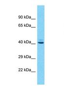 OR10J1 Antibody - Western blot of Human Jurkat. OR10J1 antibody dilution 1.0 ug/ml.  This image was taken for the unconjugated form of this product. Other forms have not been tested.