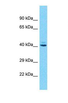 OR10J1 Antibody - Western blot of Human Jurkat. OR10J1 antibody dilution 1.0 ug/ml.  This image was taken for the unconjugated form of this product. Other forms have not been tested.
