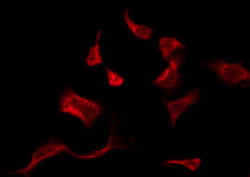 OR10J1 Antibody - Staining 293 cells by IF/ICC. The samples were fixed with PFA and permeabilized in 0.1% Triton X-100, then blocked in 10% serum for 45 min at 25°C. The primary antibody was diluted at 1:200 and incubated with the sample for 1 hour at 37°C. An Alexa Fluor 594 conjugated goat anti-rabbit IgG (H+L) Ab, diluted at 1/600, was used as the secondary antibody.