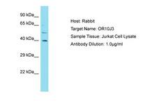 OR10J3 Antibody -  This image was taken for the unconjugated form of this product. Other forms have not been tested.