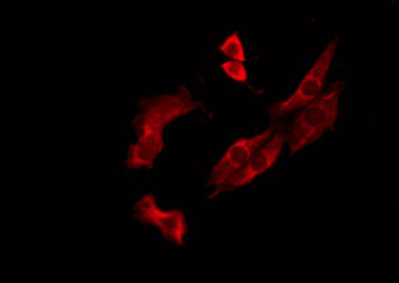 OR10J3 Antibody - Staining MCF-7 cells by IF/ICC. The samples were fixed with PFA and permeabilized in 0.1% Triton X-100, then blocked in 10% serum for 45 min at 25°C. The primary antibody was diluted at 1:200 and incubated with the sample for 1 hour at 37°C. An Alexa Fluor 594 conjugated goat anti-rabbit IgG (H+L) Ab, diluted at 1/600, was used as the secondary antibody.