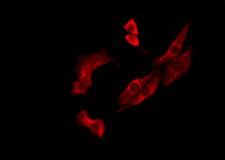 OR10J3 Antibody - Staining MCF-7 cells by IF/ICC. The samples were fixed with PFA and permeabilized in 0.1% Triton X-100, then blocked in 10% serum for 45 min at 25°C. The primary antibody was diluted at 1:200 and incubated with the sample for 1 hour at 37°C. An Alexa Fluor 594 conjugated goat anti-rabbit IgG (H+L) Ab, diluted at 1/600, was used as the secondary antibody.