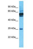 OR10J5 Antibody - OR10J5 antibody Western Blot of ACHN. Antibody dilution: 1 ug/ml.  This image was taken for the unconjugated form of this product. Other forms have not been tested.