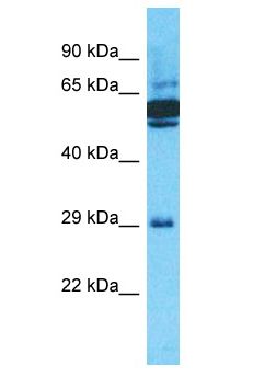 OR10J5 Antibody - OR10J5 antibody Western Blot of ACHN. Antibody dilution: 1 ug/ml.  This image was taken for the unconjugated form of this product. Other forms have not been tested.