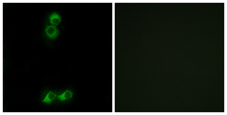 OR10J5 Antibody - Immunofluorescence analysis of MCF7 cells, using OR10J5 Antibody. The picture on the right is blocked with the synthesized peptide.