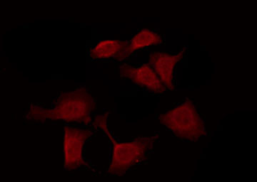 OR10J6P Antibody - Staining HeLa cells by IF/ICC. The samples were fixed with PFA and permeabilized in 0.1% Triton X-100, then blocked in 10% serum for 45 min at 25°C. The primary antibody was diluted at 1:200 and incubated with the sample for 1 hour at 37°C. An Alexa Fluor 594 conjugated goat anti-rabbit IgG (H+L) Ab, diluted at 1/600, was used as the secondary antibody.
