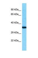 OR10K2 Antibody - Western blot of Human Fetal Kidney. OR10K2 antibody dilution 1.0 ug/ml.  This image was taken for the unconjugated form of this product. Other forms have not been tested.