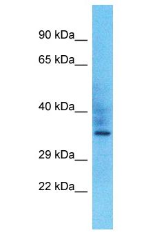 OR10P1 Antibody - OR10P1 antibody Western Blot of Fetal Liver. Antibody dilution: 1 ug/ml.  This image was taken for the unconjugated form of this product. Other forms have not been tested.