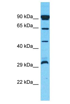 OR10P1 Antibody - OR10P1 antibody Western Blot of HT1080. Antibody dilution: 1 ug/ml.  This image was taken for the unconjugated form of this product. Other forms have not been tested.