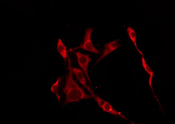 OR10R2 Antibody - Staining HeLa cells by IF/ICC. The samples were fixed with PFA and permeabilized in 0.1% Triton X-100, then blocked in 10% serum for 45 min at 25°C. The primary antibody was diluted at 1:200 and incubated with the sample for 1 hour at 37°C. An Alexa Fluor 594 conjugated goat anti-rabbit IgG (H+L) Ab, diluted at 1/600, was used as the secondary antibody.