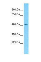OR10S1 Antibody - Western blot of Human Jurkat. OR10S1 antibody dilution 1.0 ug/ml.  This image was taken for the unconjugated form of this product. Other forms have not been tested.