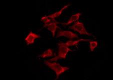 OR10S1 Antibody - Staining HeLa cells by IF/ICC. The samples were fixed with PFA and permeabilized in 0.1% Triton X-100, then blocked in 10% serum for 45 min at 25°C. The primary antibody was diluted at 1:200 and incubated with the sample for 1 hour at 37°C. An Alexa Fluor 594 conjugated goat anti-rabbit IgG (H+L) Ab, diluted at 1/600, was used as the secondary antibody.