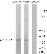 OR10T2 Antibody - Western blot analysis of lysates from HUVEC and COLO cells, using OR10T2 Antibody. The lane on the right is blocked with the synthesized peptide.