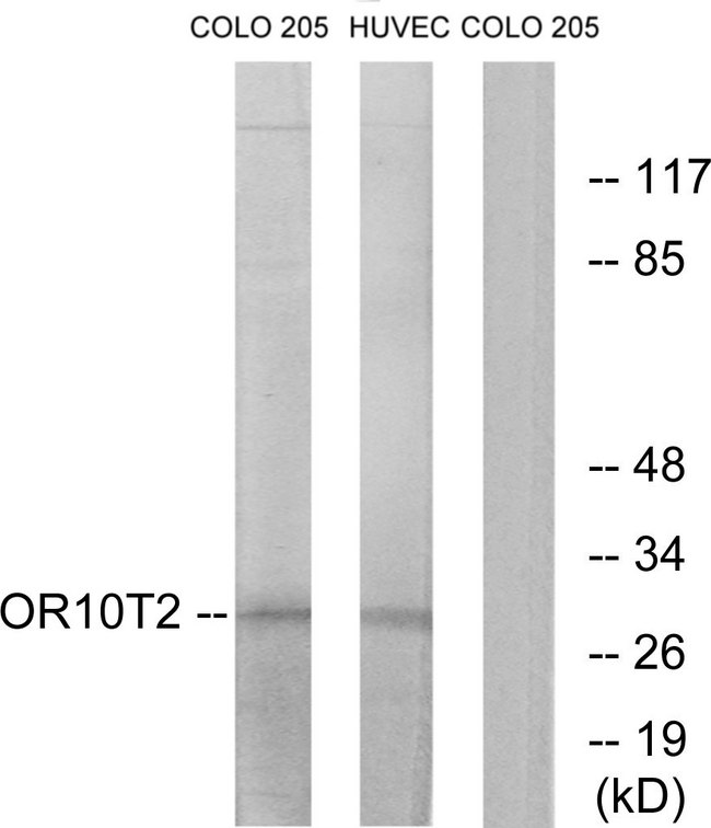 OR10T2 Antibody - Western blot analysis of lysates from HUVEC and COLO cells, using OR10T2 Antibody. The lane on the right is blocked with the synthesized peptide.