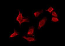 OR10T2 Antibody - Staining HuvEc cells by IF/ICC. The samples were fixed with PFA and permeabilized in 0.1% Triton X-100, then blocked in 10% serum for 45 min at 25°C. The primary antibody was diluted at 1:200 and incubated with the sample for 1 hour at 37°C. An Alexa Fluor 594 conjugated goat anti-rabbit IgG (H+L) Ab, diluted at 1/600, was used as the secondary antibody.