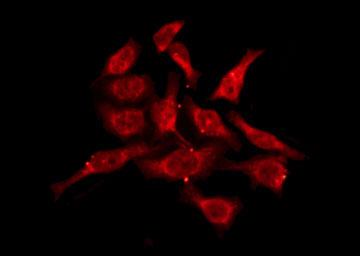 OR10V1 Antibody - Staining A549 cells by IF/ICC. The samples were fixed with PFA and permeabilized in 0.1% Triton X-100, then blocked in 10% serum for 45 min at 25°C. The primary antibody was diluted at 1:200 and incubated with the sample for 1 hour at 37°C. An Alexa Fluor 594 conjugated goat anti-rabbit IgG (H+L) Ab, diluted at 1/600, was used as the secondary antibody.