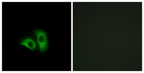 OR10X1 Antibody - Immunofluorescence of A549 cells, using OR10X1 Antibody. The picture on the right is treated with the synthesized peptide.