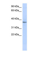 OR10X1 Antibody - OR10X1 antibody Western blot of Fetal Muscle lysate. This image was taken for the unconjugated form of this product. Other forms have not been tested.
