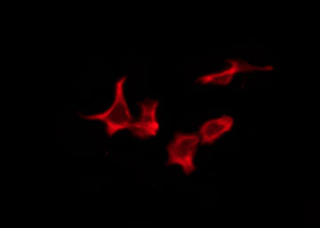 OR10Z1 Antibody - Staining HeLa cells by IF/ICC. The samples were fixed with PFA and permeabilized in 0.1% Triton X-100, then blocked in 10% serum for 45 min at 25°C. The primary antibody was diluted at 1:200 and incubated with the sample for 1 hour at 37°C. An Alexa Fluor 594 conjugated goat anti-rabbit IgG (H+L) Ab, diluted at 1/600, was used as the secondary antibody.