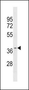 OR11A1 Antibody - OR11A1 Antibody western blot of MDA-MB453 cell line lysates (35 ug/lane). The OR11A1 antibody detected the OR11A1 protein (arrow).