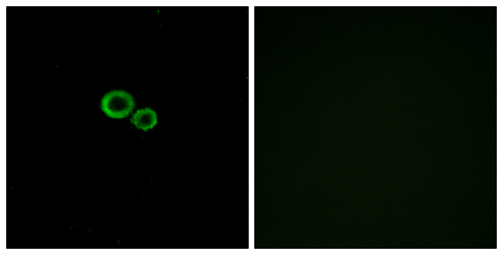 OR11G2 Antibody - Immunofluorescence analysis of A549 cells, using OR11G2 Antibody. The picture on the right is blocked with the synthesized peptide.