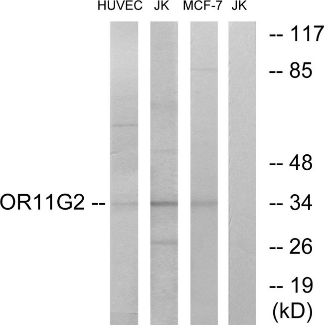 OR11G2 Antibody - Western blot analysis of lysates from HUVEC, Jurkat, and MCF-7 cells, using OR11G2 Antibody. The lane on the right is blocked with the synthesized peptide.