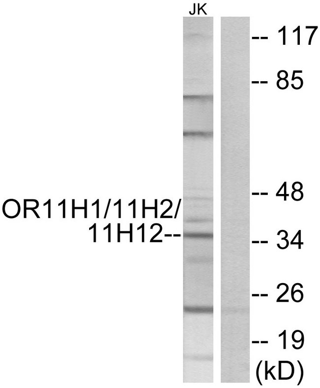 OR11H1+2+12 Antibody - Western blot analysis of lysates from Jurkat cells, using OR11H1/11H2/11H12 Antibody. The lane on the right is blocked with the synthesized peptide.